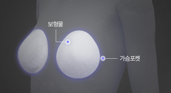 퍼펙트 핏 드라이포켓 테크닉